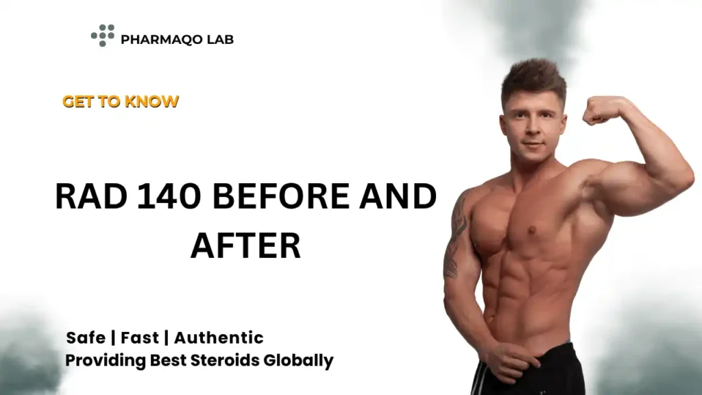Rad 140 Before and After